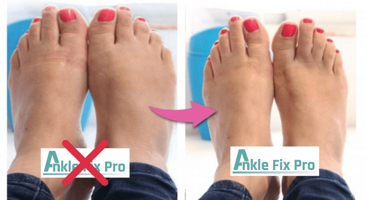 Ankle Fix Pro