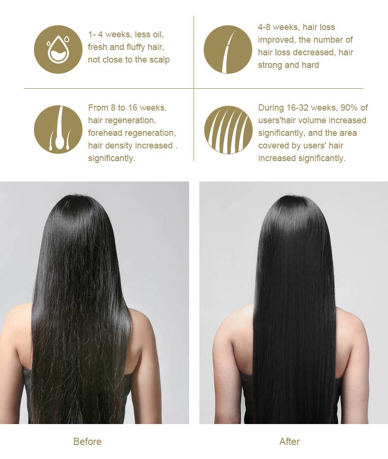 Before and after using laser hair growth comb
