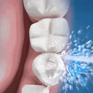 A virtual representation on how dental flosser work
