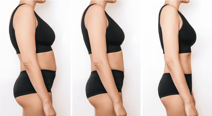 Before and after using Sleemah Slimming Girdle