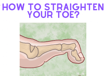 How to straighten your toes