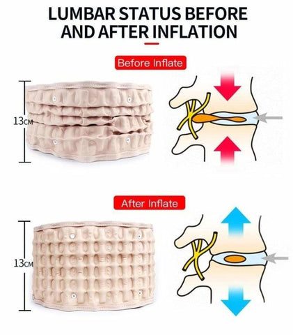 Before and After using LumbarCorrect
