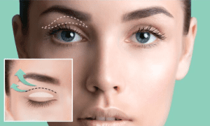 How to Lift Hooded Eyelids